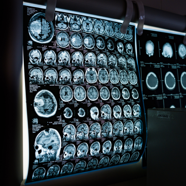 Digital X-Ray